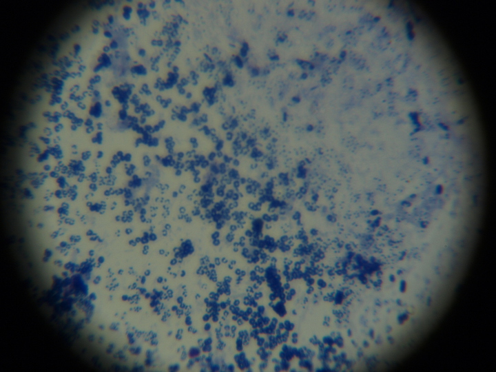 Biofouling mycobacterium